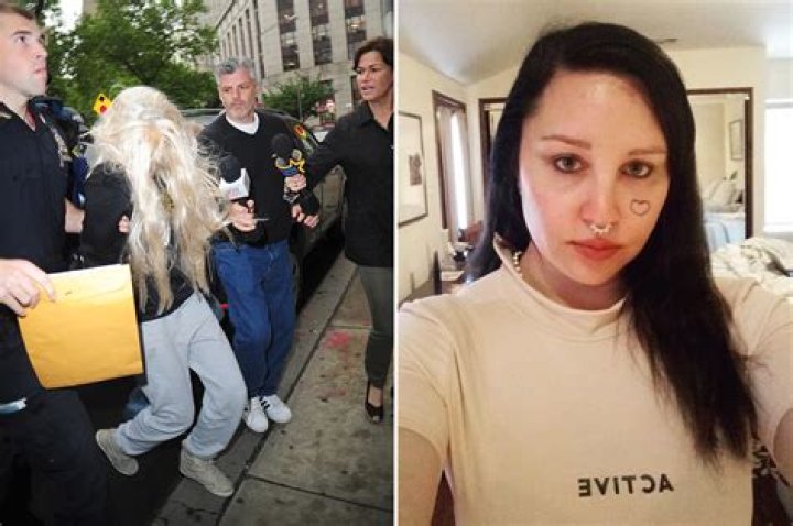 Amanda Bynes and Her Lobotomy: A Journey Through Mental Health Challenges