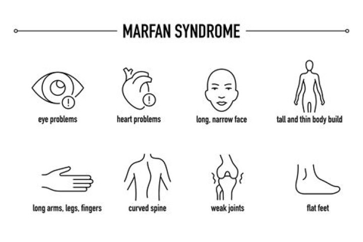 Is Barron Trump's Health Condition Marfan Syndrome? All You Need to Know