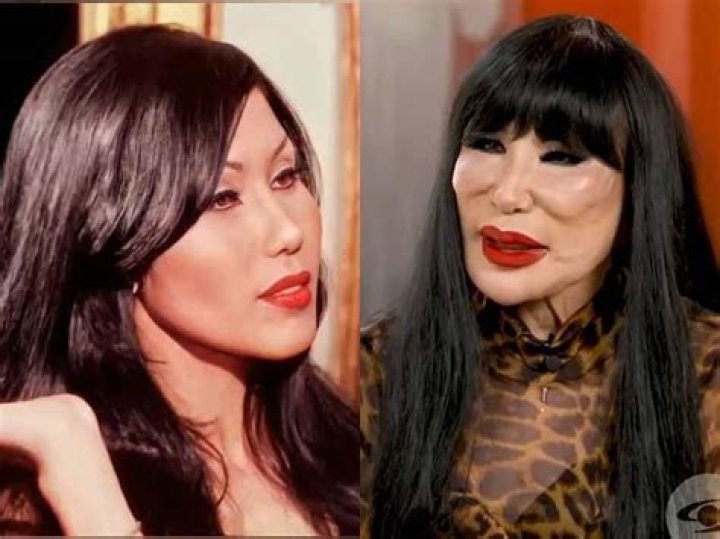 Lyn May Face: The Iconic Journey of a Legendary Performer