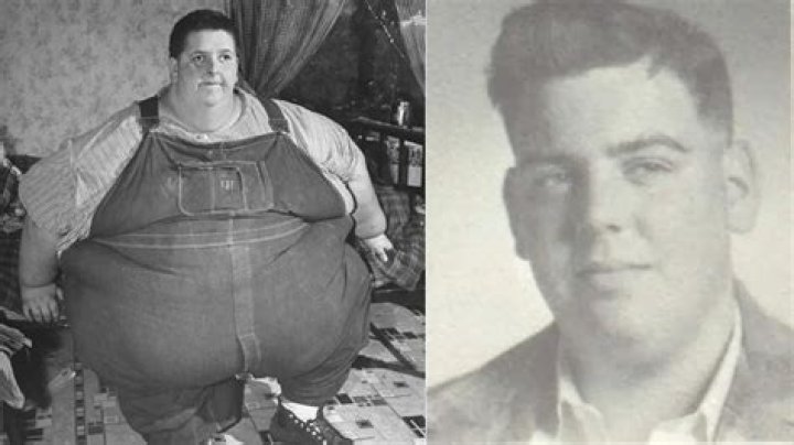 The Fattest Person in the World: A Deep Dive into Obesity and Its Impact