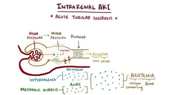 The Ultimate Guide to Aki-h: Everything You Need to Know